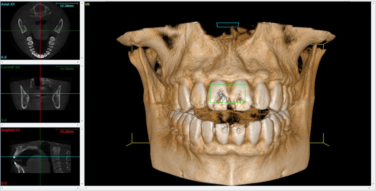 Cone Beam 3D Imaging Oxon Hill, MD 
